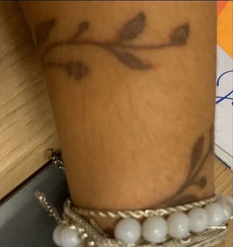 Antes: tatuagem antiga de ramo no antebraço